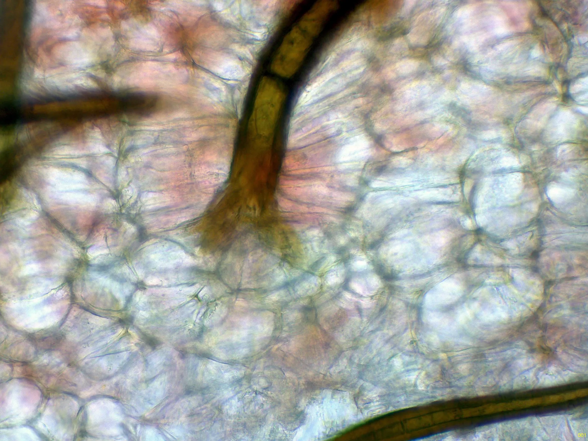 Microscopía de Scutellinia scutellata - 10 - Base pelos x 400-001